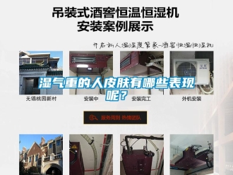 知識百科濕氣重的人皮膚有哪些表現(xiàn)呢？